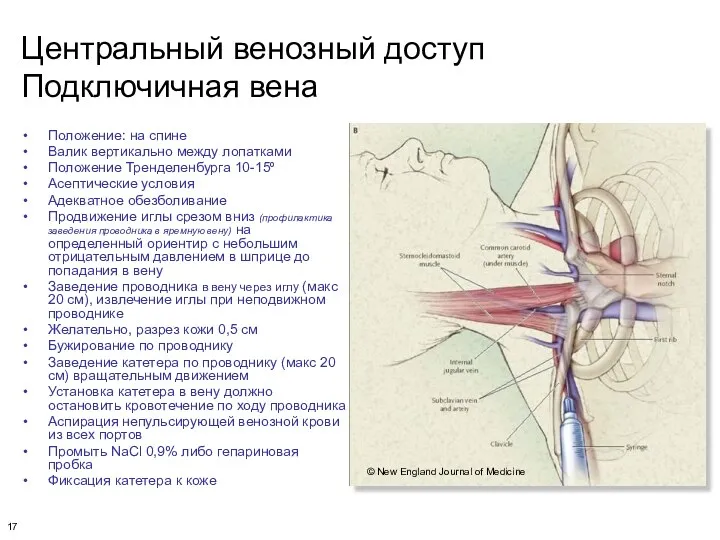 Центральный венозный доступ Подключичная вена Положение: на спине Валик вертикально