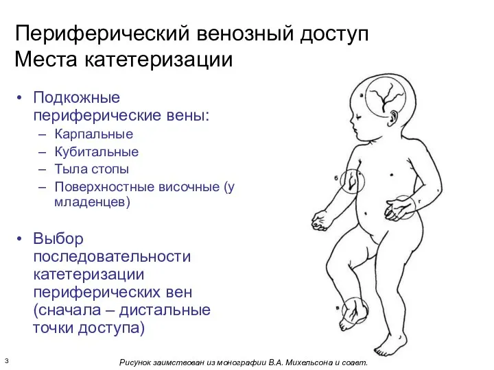 Периферический венозный доступ Места катетеризации Подкожные периферические вены: Карпальные Кубитальные