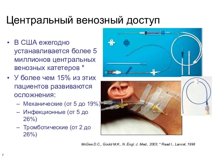 Центральный венозный доступ В США ежегодно устанавливается более 5 миллионов