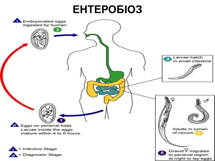 ЕНТЕРОБІОЗ