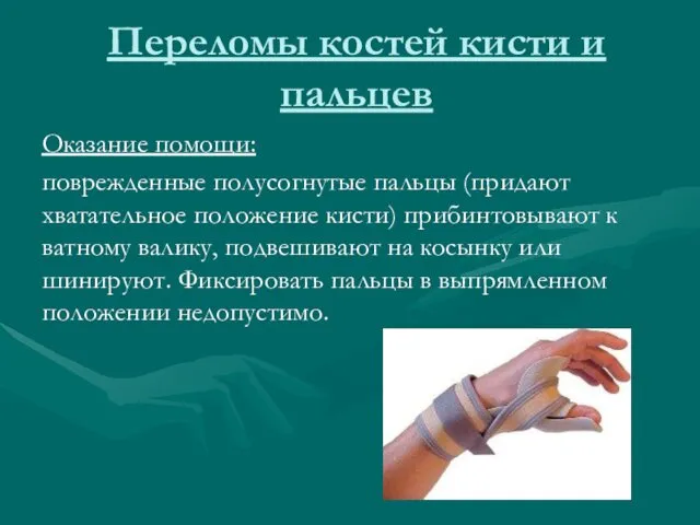Переломы костей кисти и пальцев Оказание помощи: поврежденные полусогнутые пальцы