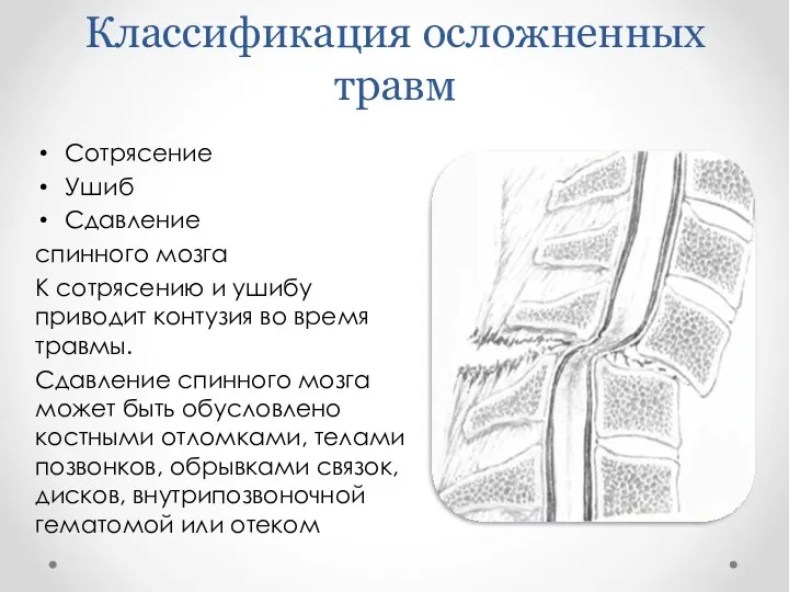 Классификация осложненных травм Сотрясение Ушиб Сдавление спинного мозга К сотрясению