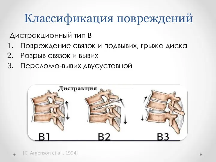 Классификация повреждений Дистракционный тип В Повреждение связок и подвывих, грыжа