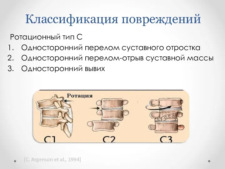 Классификация повреждений Ротационный тип С Односторонний перелом суставного отростка Односторонний