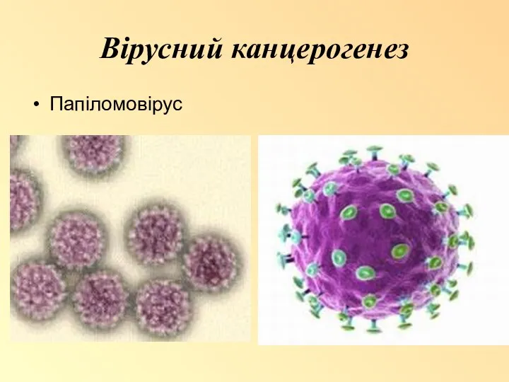 Вірусний канцерогенез Папіломовірус