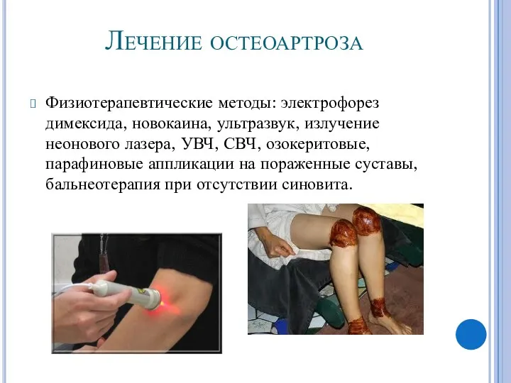 Лечение остеоартроза Физиотерапевтические методы: электрофорез димексида, новокаина, ультразвук, излучение неонового