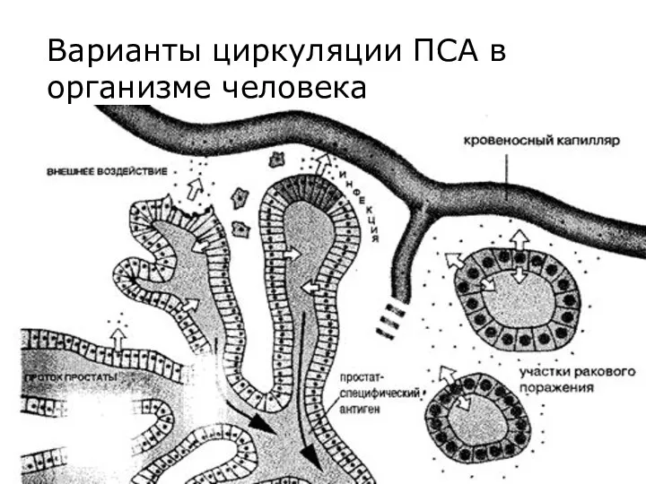 Варианты циркуляции ПСА в организме человека