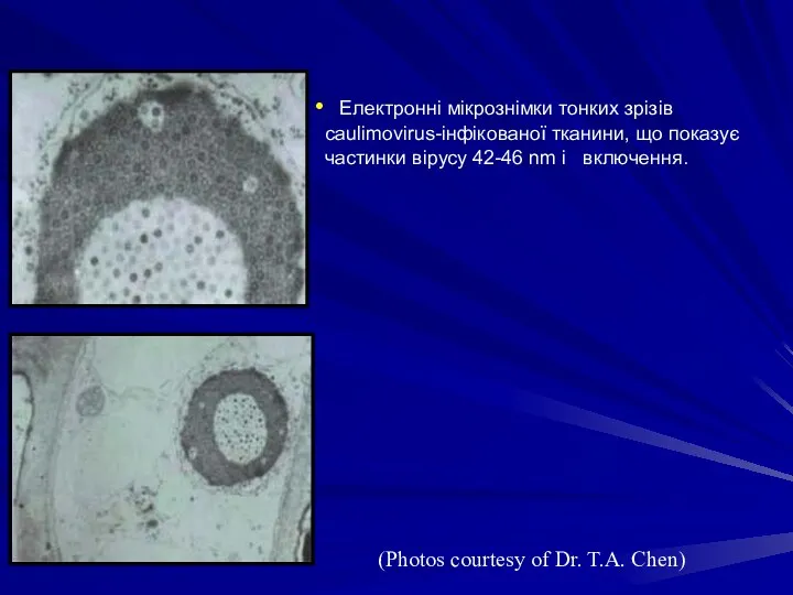 Електронні мікрознімки тонких зрізів caulimovirus-інфікованої тканини, що показує частинки вірусу