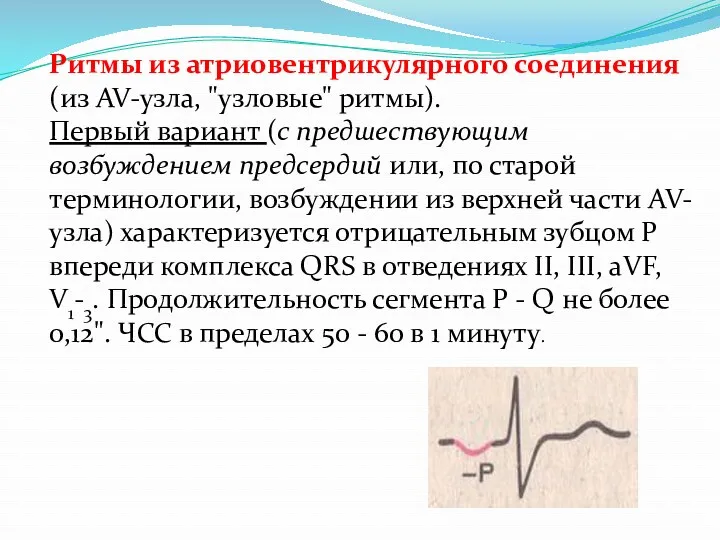 Ритмы из атриовентрикулярного соединения (из AV-узла, "узловые" ритмы). Первый вариант