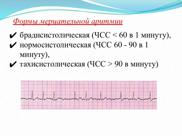 Формы мерцательной аритмии брадисистолическая (ЧСС нормосистолическая (ЧСС 60 - 90
