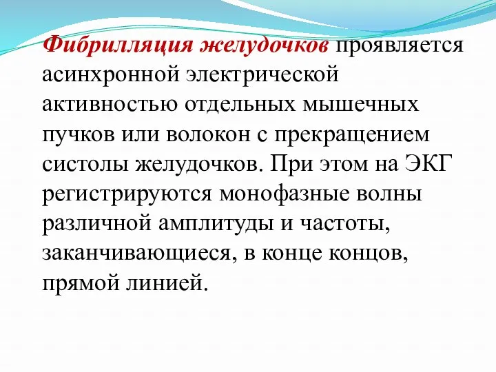 Фибрилляция желудочков проявляется асинхронной электрической активностью отдельных мышечных пучков или