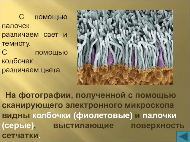 На фотографии, полученной с помощью сканирующего электронного микроскопа видны колбочки (фиолетовые) и палочки