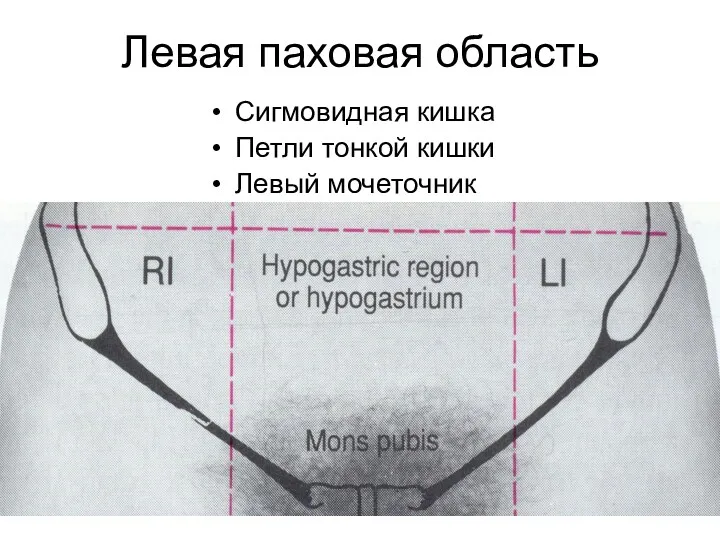 Левая паховая область Сигмовидная кишка Петли тонкой кишки Левый мочеточник