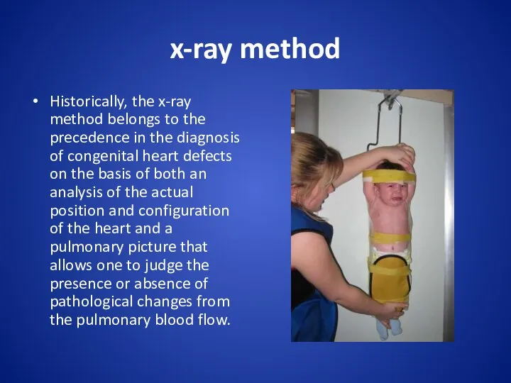 x-ray method Historically, the x-ray method belongs to the precedence in the diagnosis