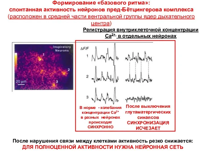 В норме - колебания концентрации Са2+ в разных нейронах происходят
