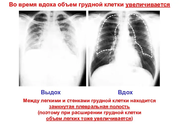 Во время вдоха объем грудной клетки увеличивается Выдох Вдох Между