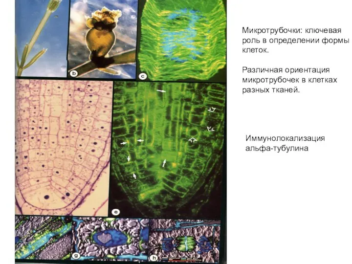 Иммунолокализация альфа-тубулина Микротрубочки: ключевая роль в определении формы клеток. Различная ориентация микротрубочек в клетках разных тканей.