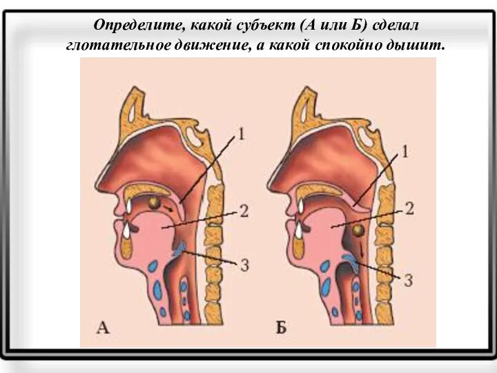 Определите, какой субъект (А или Б) сделал глотательное движение, а какой спокойно дышит.