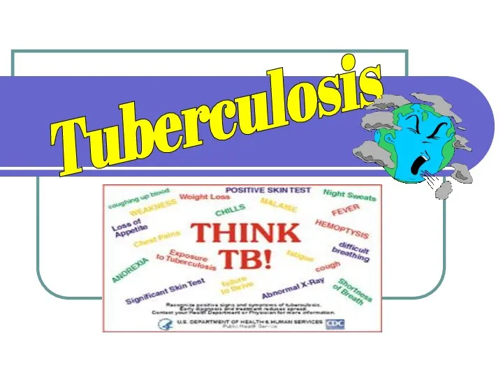 Tuberculosis