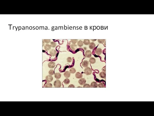 Тrypanosoma. gambiense в крови