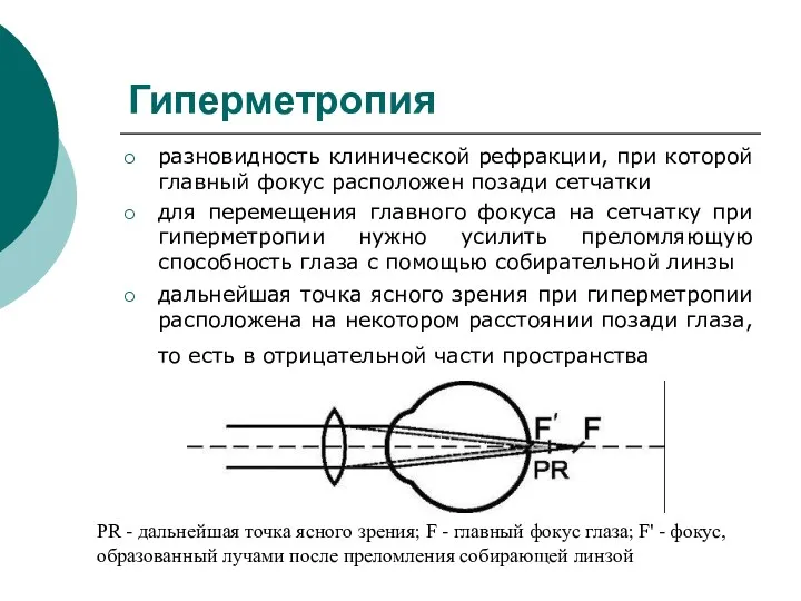 Гиперметропия разновидность клинической рефракции, при которой главный фокус расположен позади