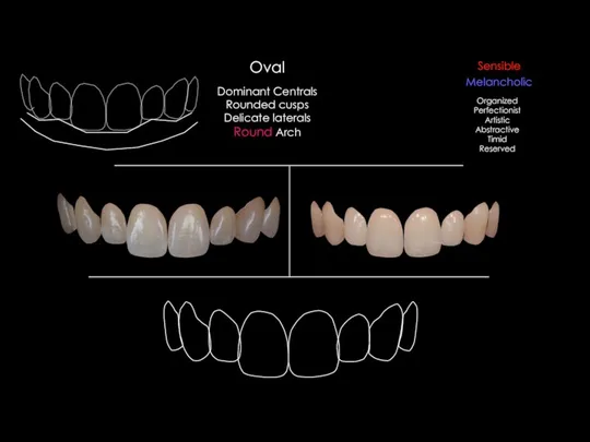 Dominant Centrals Rounded cusps Delicate laterals Round Arch Oval Melancholic