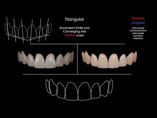 Ascendant Smile Line Converging Axis Incline cusps Triangular Sanguine Dynamic Extroverted Communicative enthusiastic Dynamic Impulsive