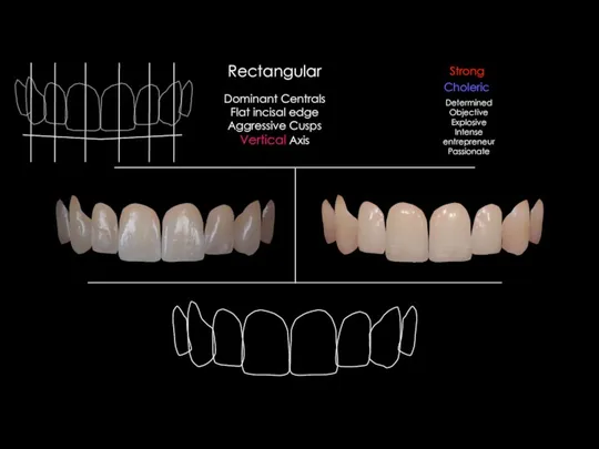 Dominant Centrals Flat incisal edge Aggressive Cusps Vertical Axis Rectangular