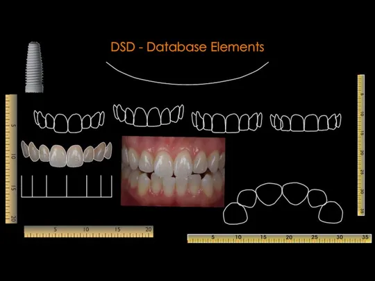DSD - Database Elements