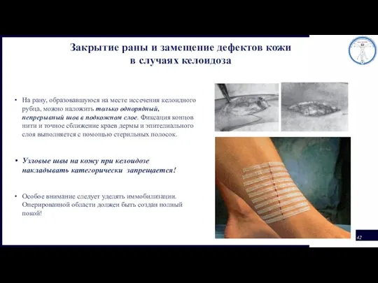 Закрытие раны и замещение дефектов кожи в случаях келоидоза На