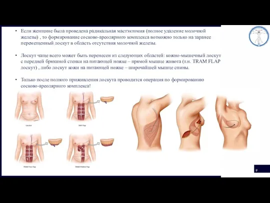 Если женщине была проведена радикальная мастэктомия (полное удаление молочной железы)