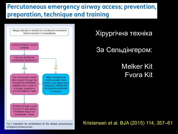 Kristensen et al. BJA (2015) 114, 357–61 Хірургічна техніка За Сельдінгером: Melker Kit Fvora Kit