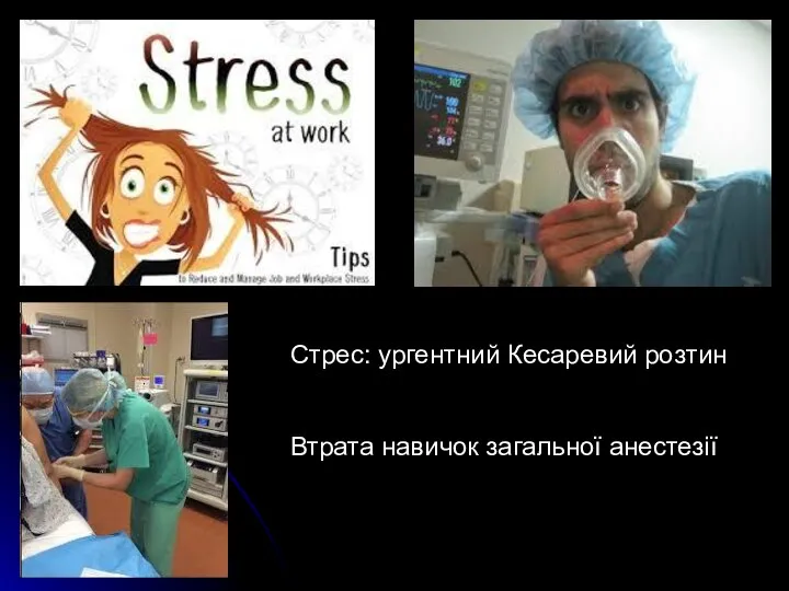 Стрес: ургентний Кесаревий розтин Втрата навичок загальної анестезії