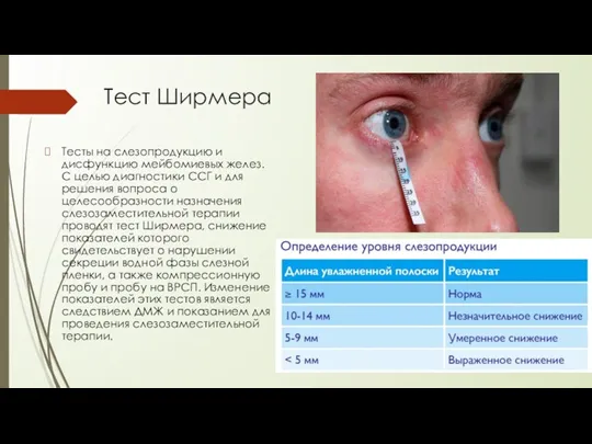 Тест Ширмера Тесты на слезопродукцию и дисфункцию мейбомиевых желез. С