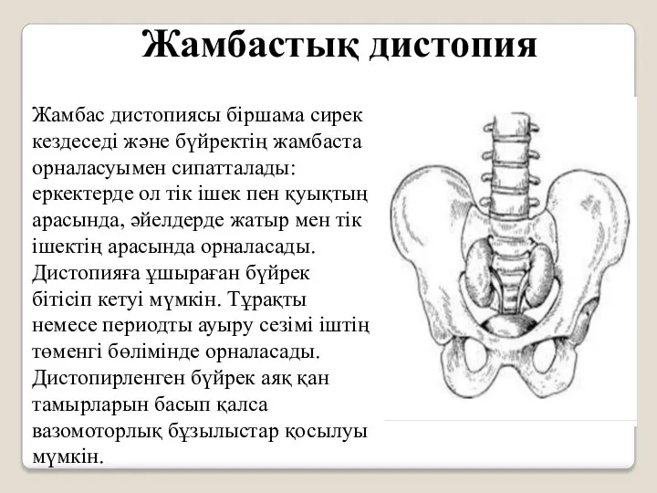 Жамбастық дистопия Жамбас дистопиясы біршама сирек кездеседі және бүйректің жамбаста