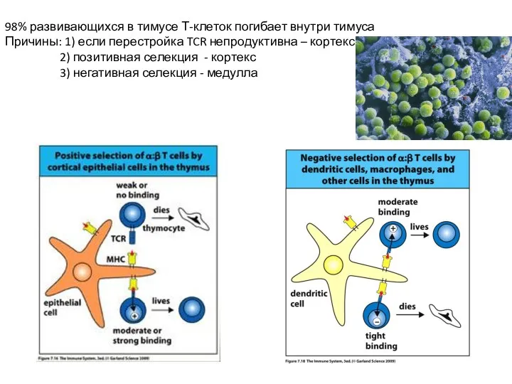98% развивающихся в тимусе Т-клеток погибает внутри тимуса Причины: 1)