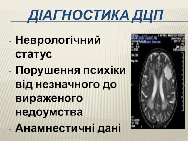 ДІАГНОСТИКА ДЦП Неврологічний статус Порушення психіки від незначного до вираженого недоумства Анамнестичні дані