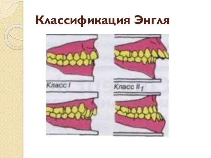 Классификация Энгля