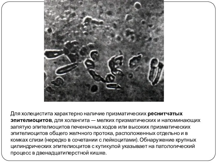 Для холецистита характерно наличие призматических реснитчатых эпителиоцитов, для холангита — мелких призматических и