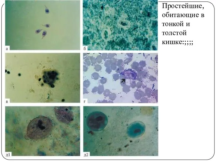 Простейшие, обитающие в тонкой и толстой кишке:;;;;