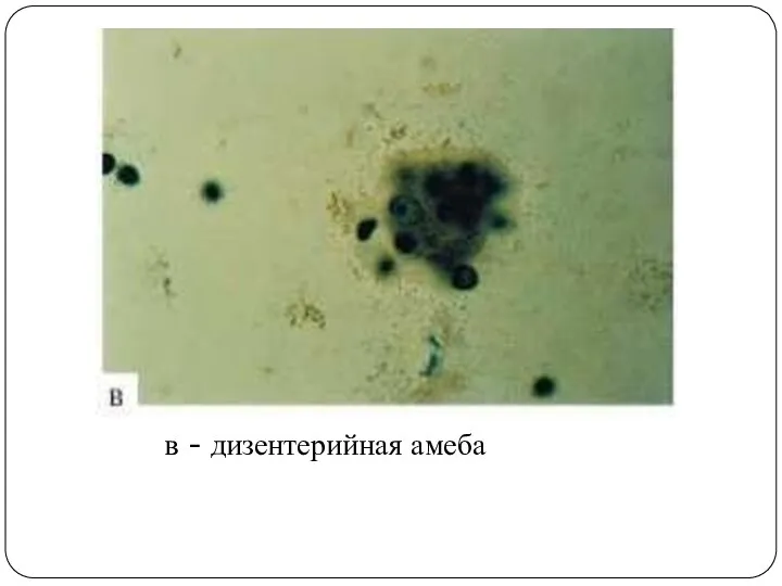 в - дизентерийная амеба