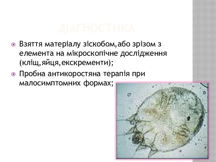 ДІАГНОСТИКА Взяття матеріалу зіскобом,або зрізом з елемента на мікроскопічне дослідження(кліщ,яйця,екскременти); Пробна антикоростяна терапія при малосимптомних формах;