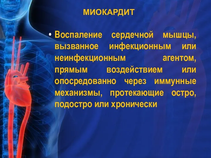 МИОКАРДИТ Воспаление сердечной мышцы, вызванное инфекционным или неинфекционным агентом, прямым