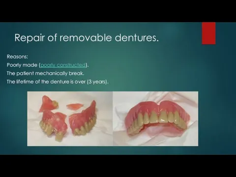 Repair of removable dentures. Reasons: Poorly made (poorly constructed). The patient mechanically break.