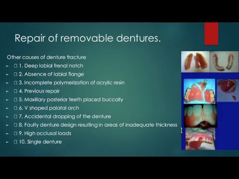 Repair of removable dentures. Other causes of denture fracture  1. Deep labial