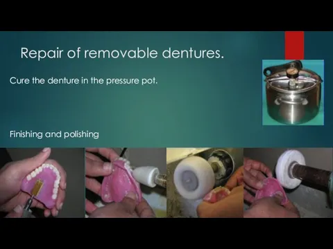 Repair of removable dentures. Cure the denture in the pressure pot. Finishing and polishing