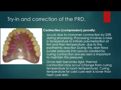 Try-in and correction of the PRD. Contraction (compression) porosity: occurs due to monomer