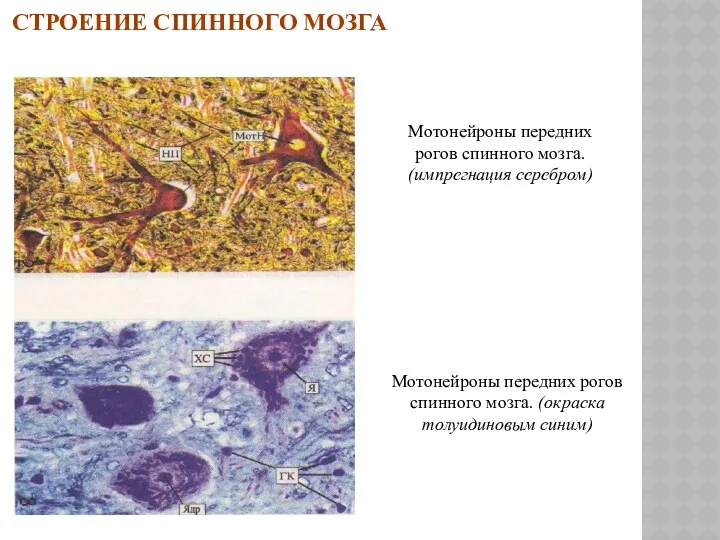 СТРОЕНИЕ СПИННОГО МОЗГА Мотонейроны передних рогов спинного мозга. (импрегнация серебром)