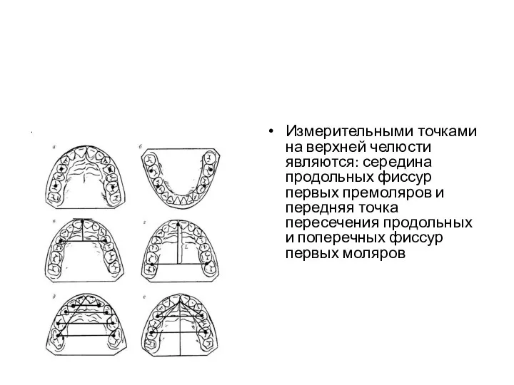 . Измерительными точками на верхней челюсти являются: середина продольных фиссур