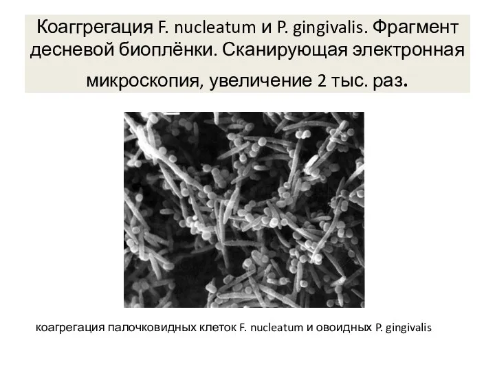 Коаггрегация F. nucleatum и P. gingivalis. Фрагмент десневой биоплёнки. Сканирующая